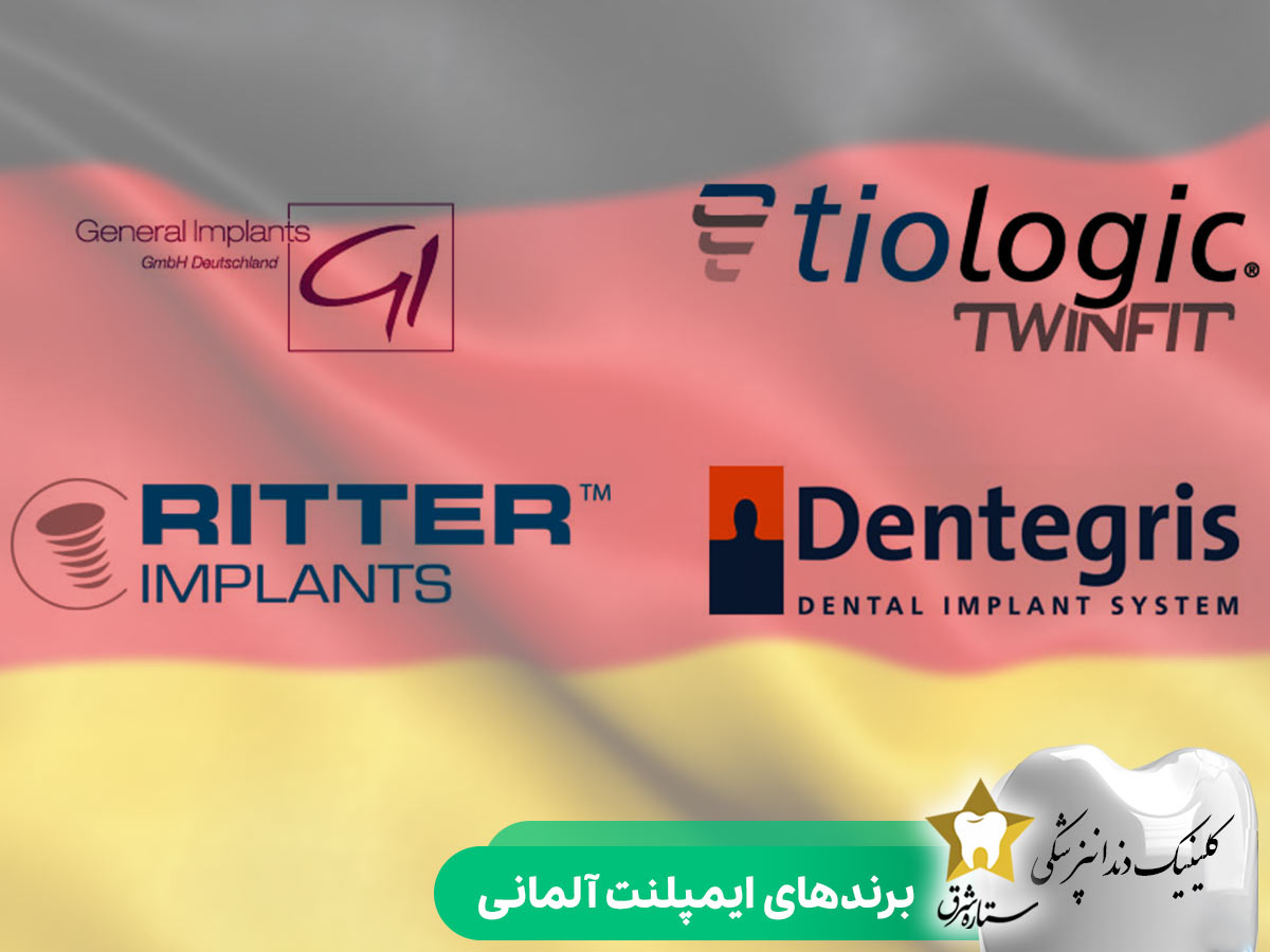 برندهای ایمپلنت آلمانی