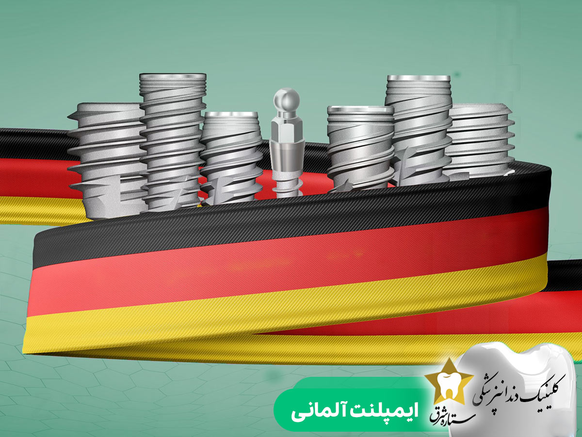 ایمپلنت آلمانی