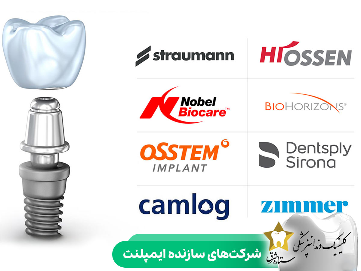 شرکت‌های سازنده ایمپلنت
