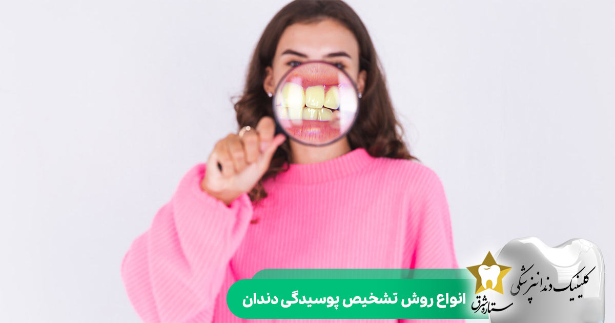 انواع روش تشخیص پوسیدگی دندان