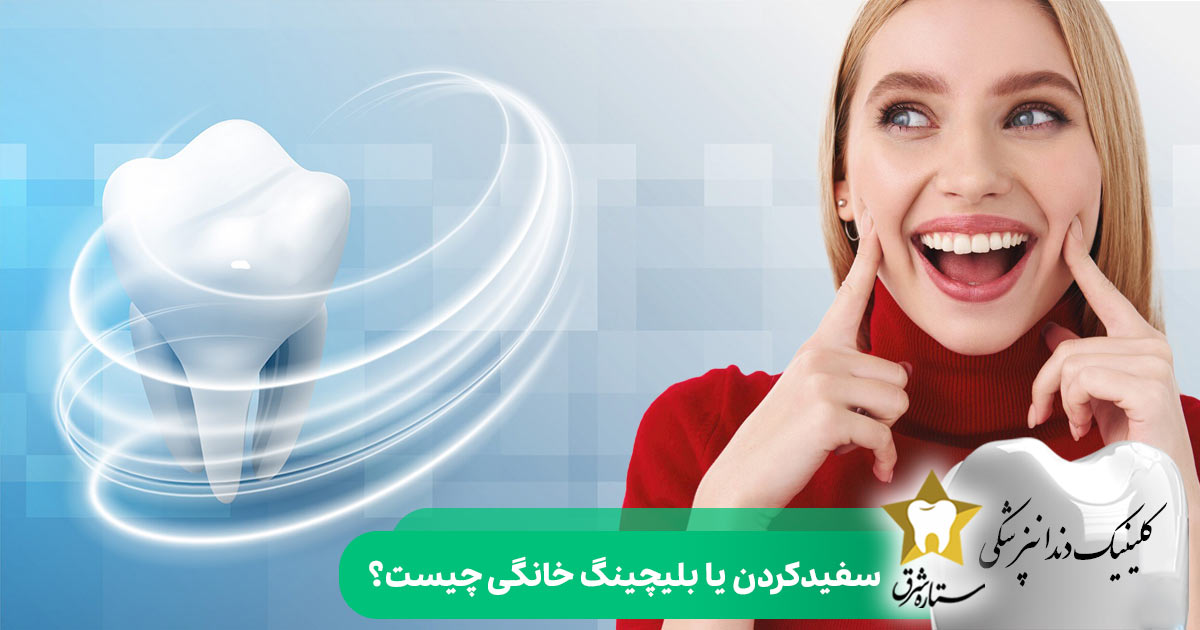 سفید کردن یا بلیچینگ خانگی چیست