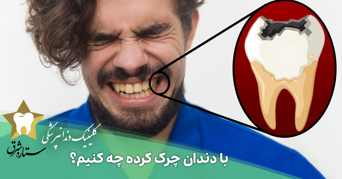 با دندان چرک‌ کرده چه کنیم؟