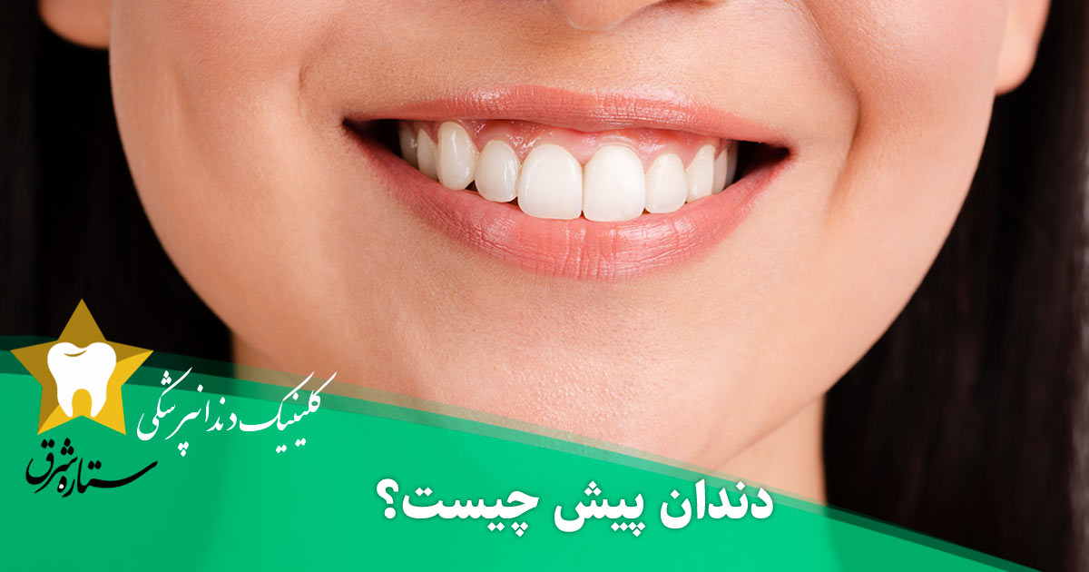 دندان پیش چیست و تفاوت آن با دندان نیش