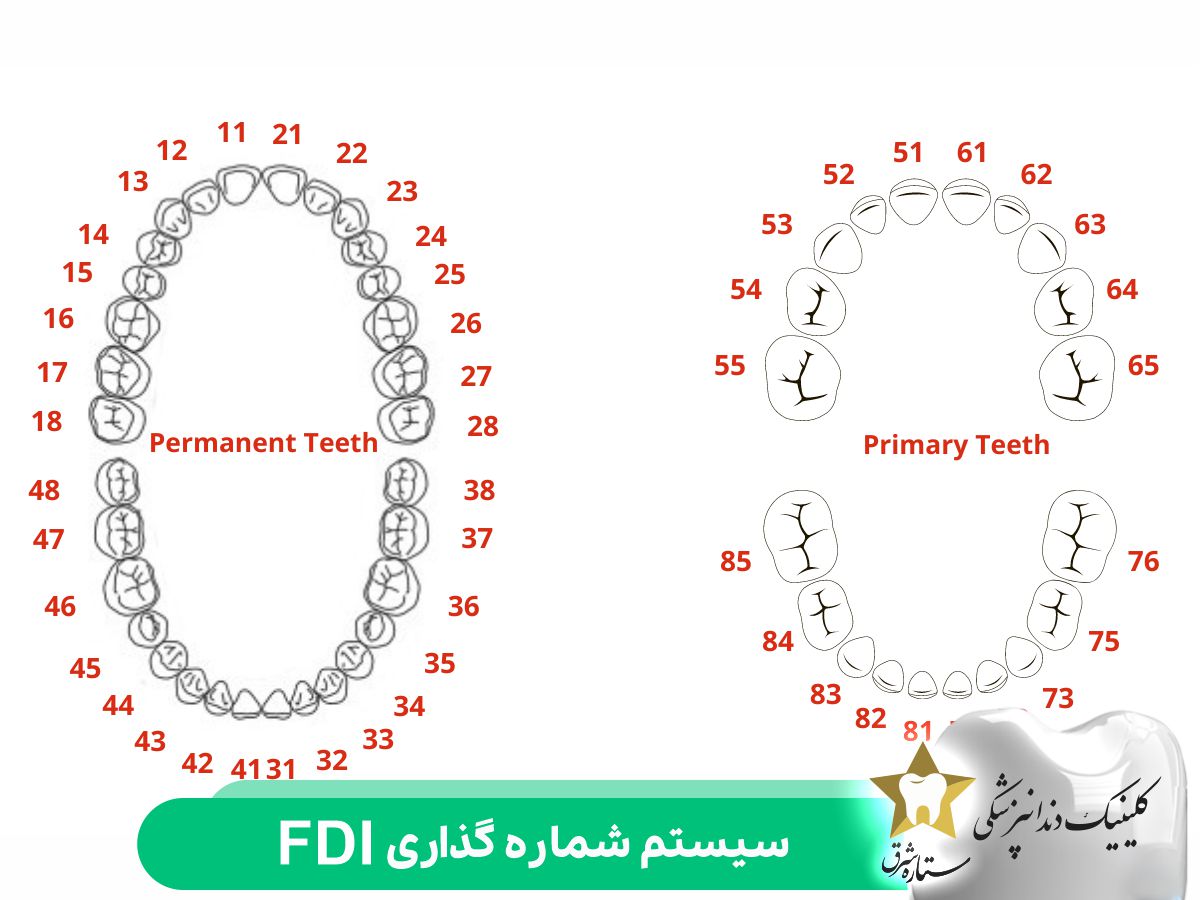 سیستم علامتگذاری فدراسیون جهانی دندانپزشکی