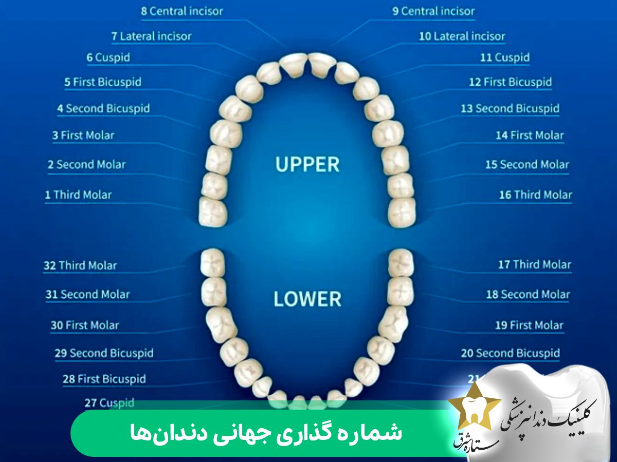 سیستم شمارهگذاری جهانی دندان