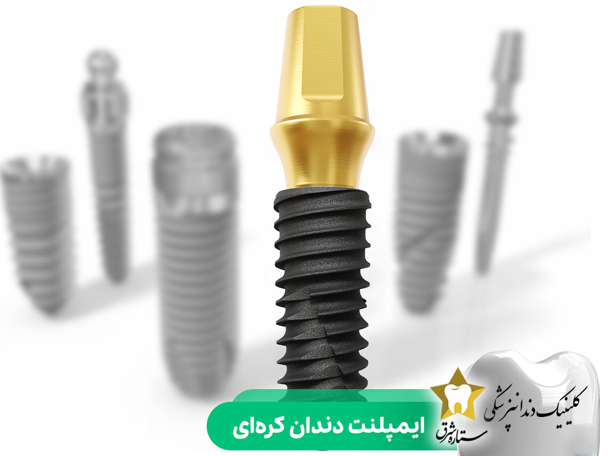 ایمپلنت دندان کره ای