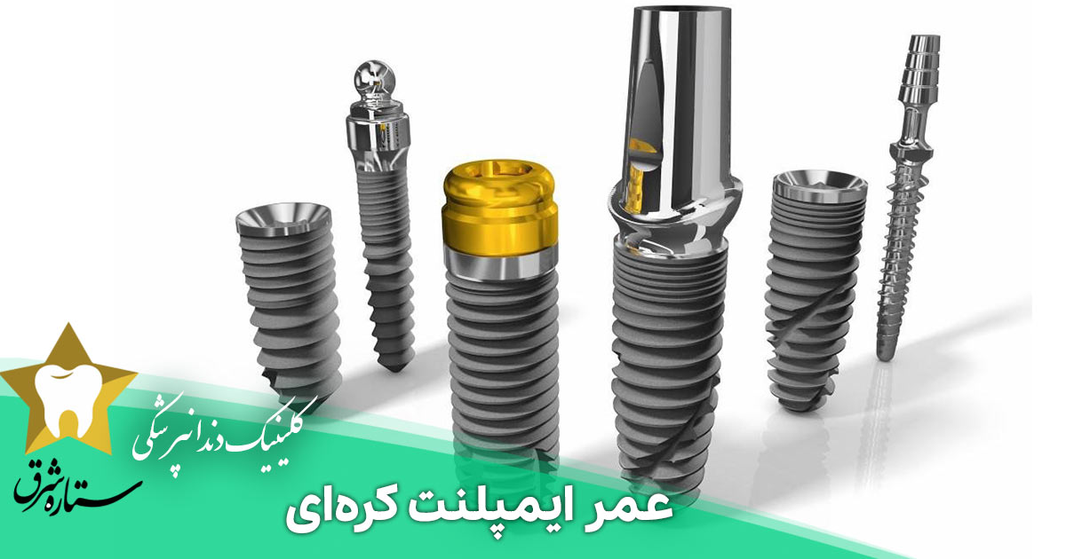 عمر ایمپلنت کره‌ای