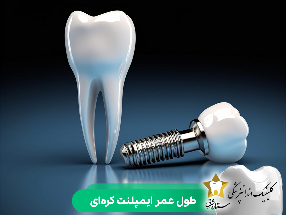 طول عمر ایمپلنت کره ای