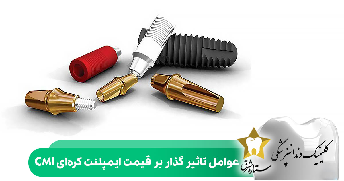 عوامل تاثیرگذار بر قیمت ایمپلنت