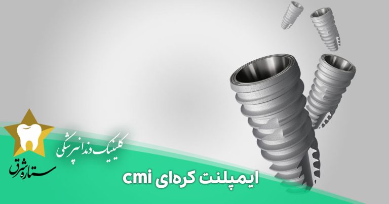 همه چیز درباره ایمپلنت کره‌ای cmi و قیمت آن