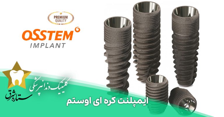 نکاتی درباره ایمپلنت کره ای اوستم و قیمت آن