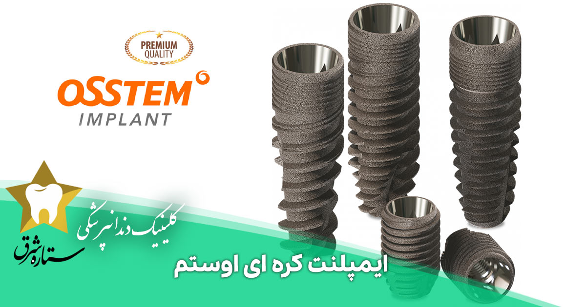نکاتی درباره ایمپلنت کره ای اوستم و قیمت آن