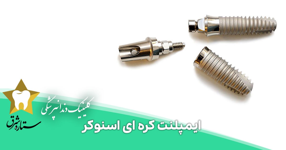 همه چیز درباره ایمپلنت کره ای اسنوکر