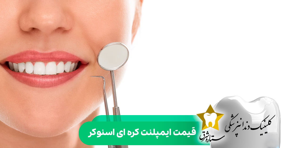 قیمت ایمپلنت کره ای اسنوکر
