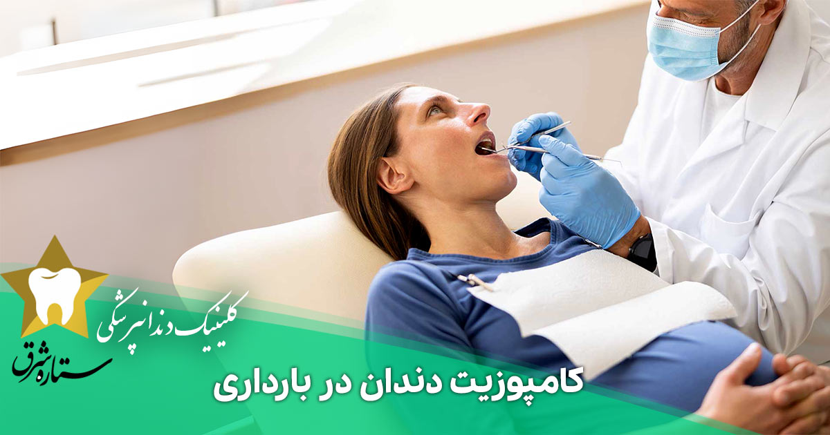 کامپوزیت دندان در بارداری