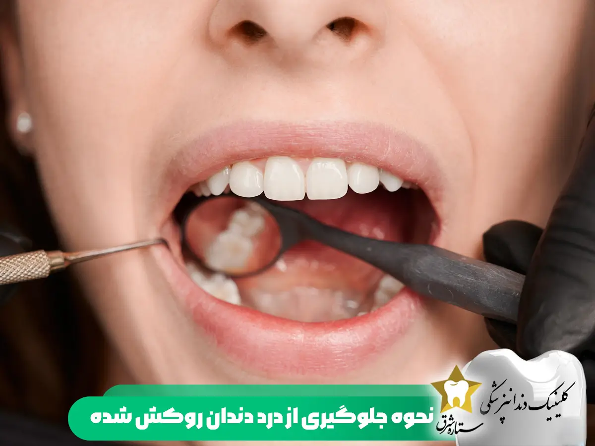 نحوه جلوگیری از درد دندان روکش شده