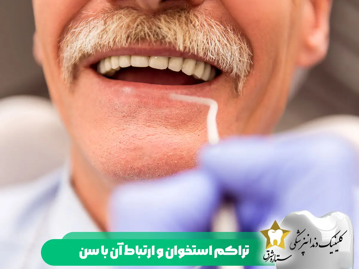 سن مناسب برای ایمپلنت دندان