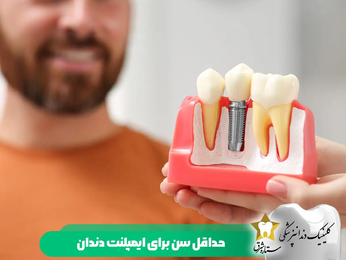 حداقل سن مناسب ایمپلنت دندان