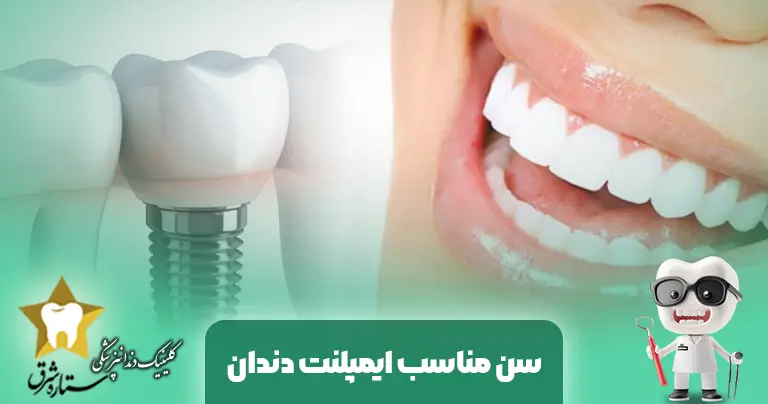 سن مناسب ایمپلنت دندان