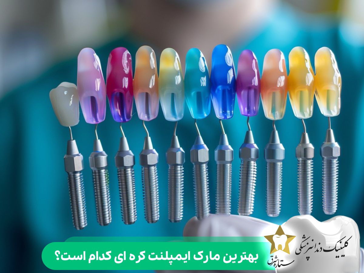 بهترین مارک ایمپلنت کره ای کدام است؟