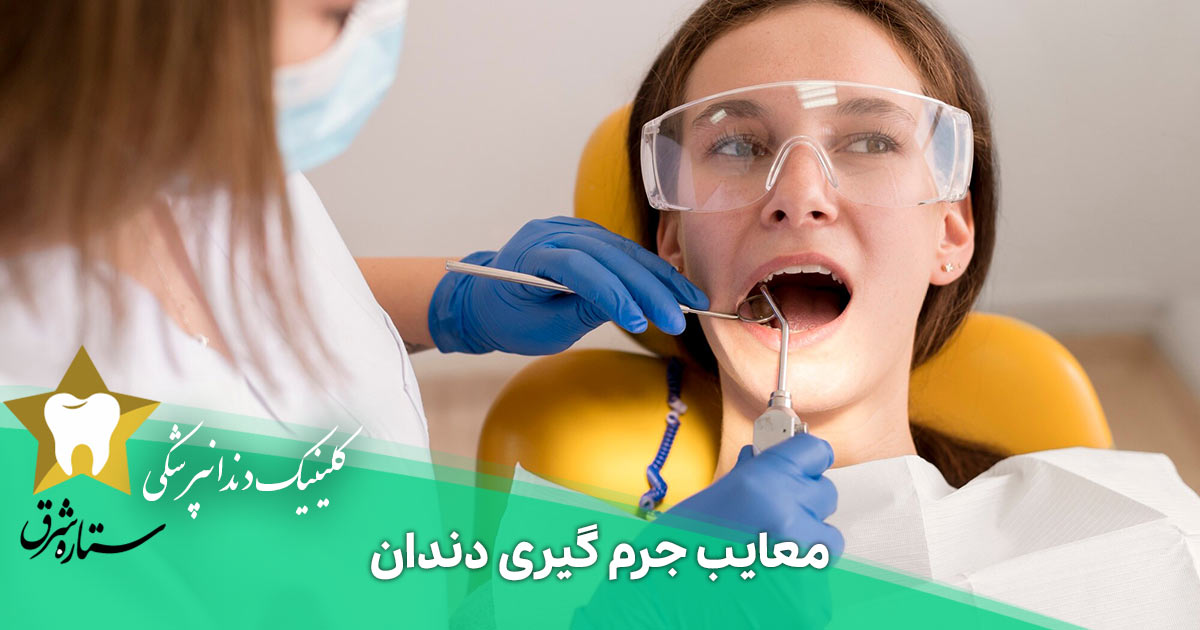 معایب جرم گیری دندان که نمیخواهند بدانید