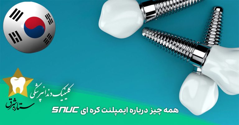  همه چیز درباره ایمپلنت کره ای snuc