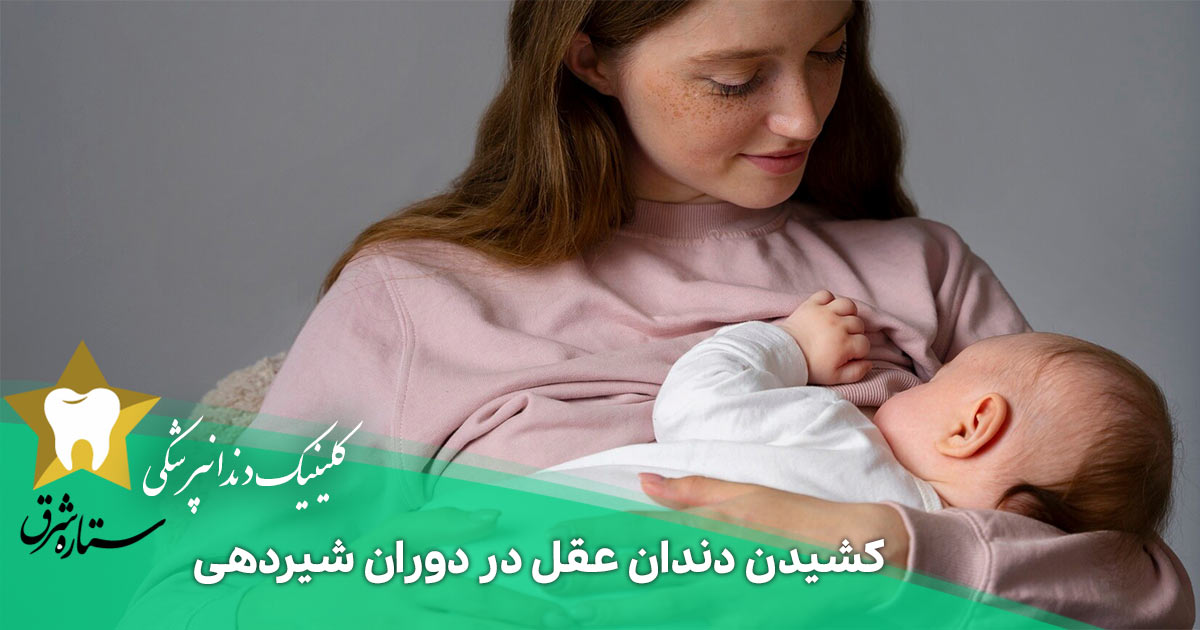 کشیدن دندان عقل در دوران شیردهی؛ نکاتی که نمی‌دانستید