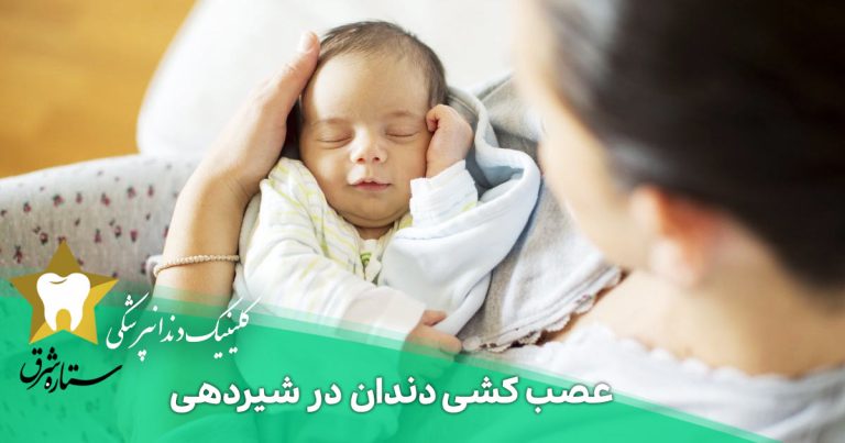 عصب کشی دندان در شیردهی _ هر آنچه باید بدانید