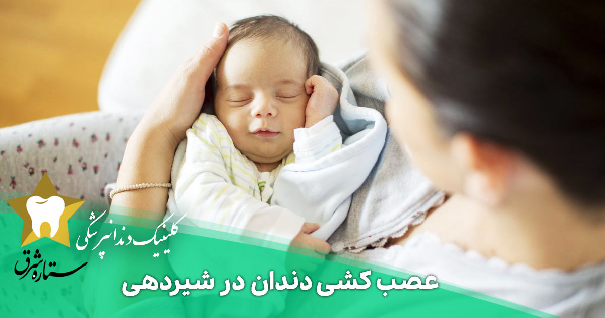 عصب کشی دندان در شیردهی _ هر آنچه باید بدانید