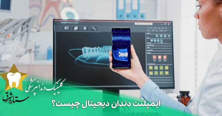 ایمپلنت دندان دیجیتال چیست؟