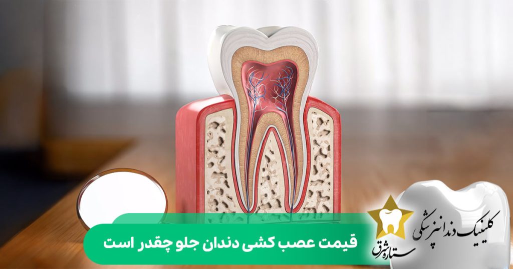 قیمت عصب کشی دندان جلو