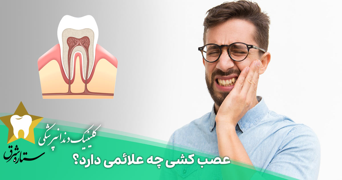 عصب کشی چه علائمی دارد