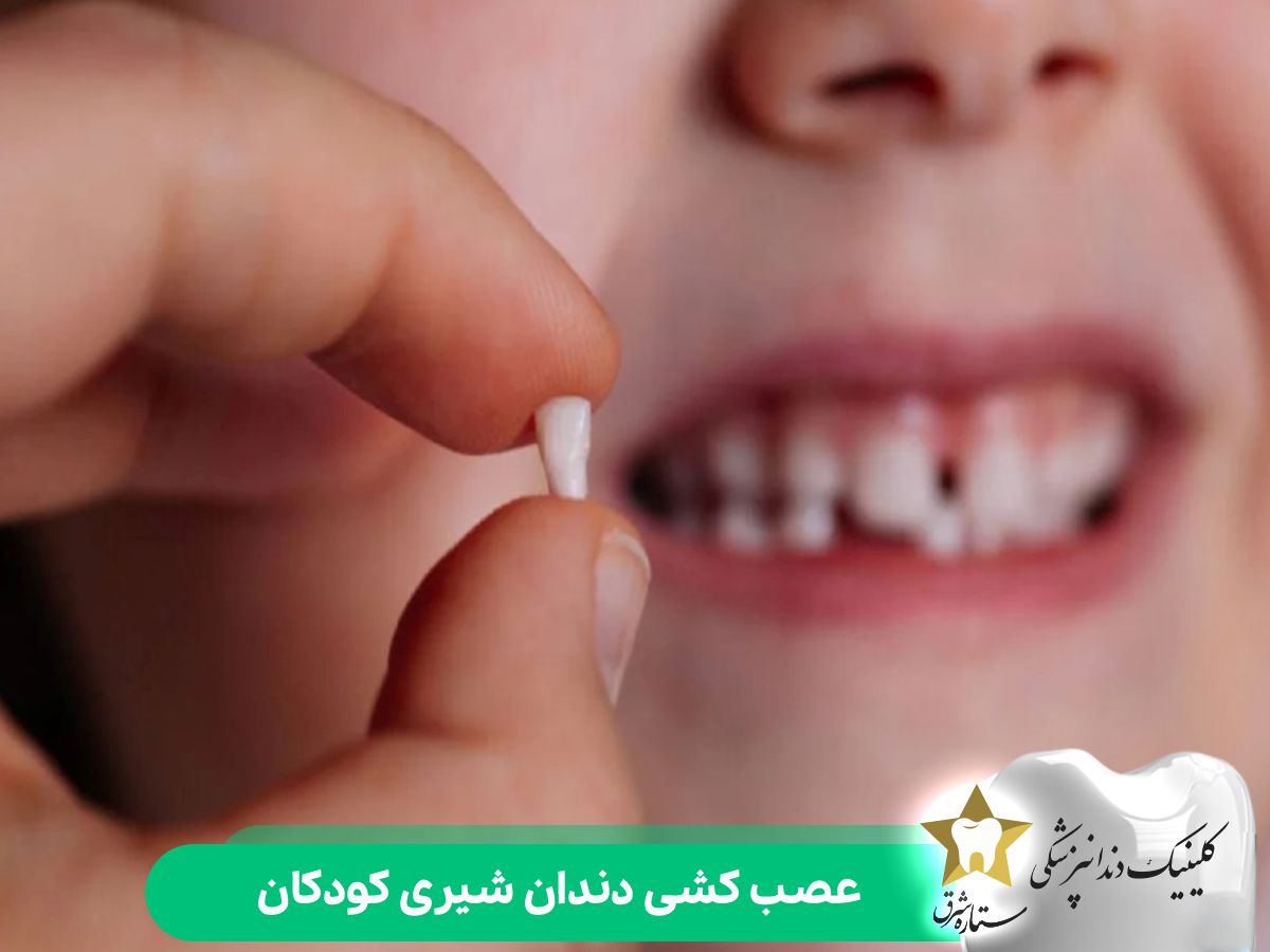 عصب کشی دندان شیری در کودکان