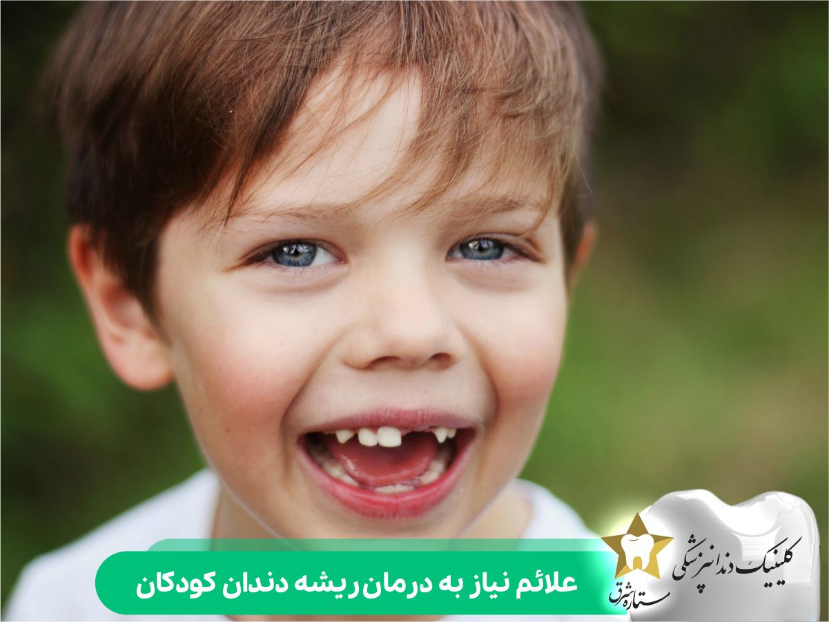 علائم نیاز به درمان ریشه کودکان