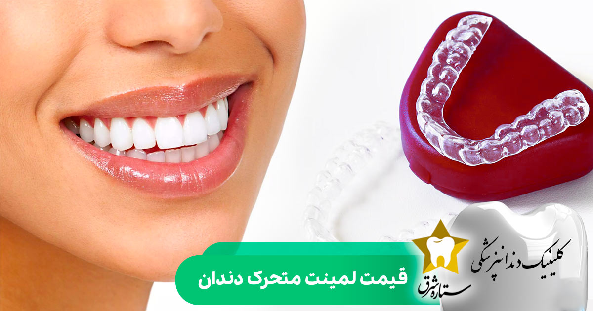 قیمت لمینت دندان