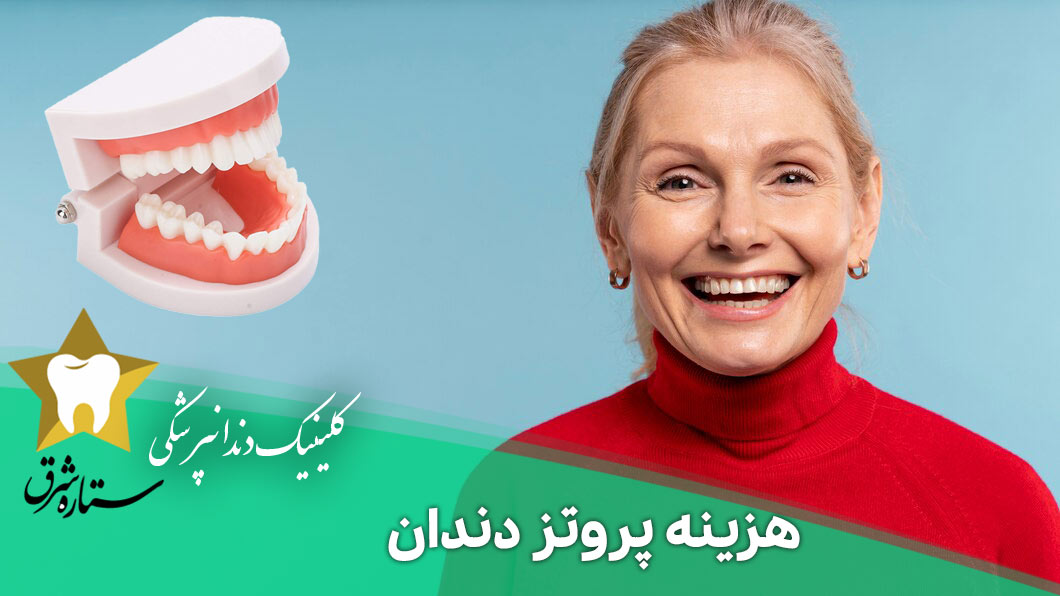 هزینه پروتز دندان