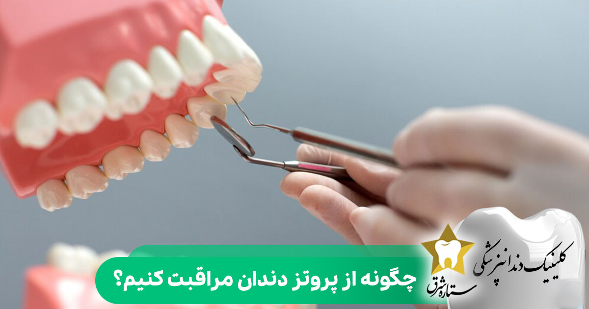 چگونه از پروتز دندان مراقبت کنیم؟