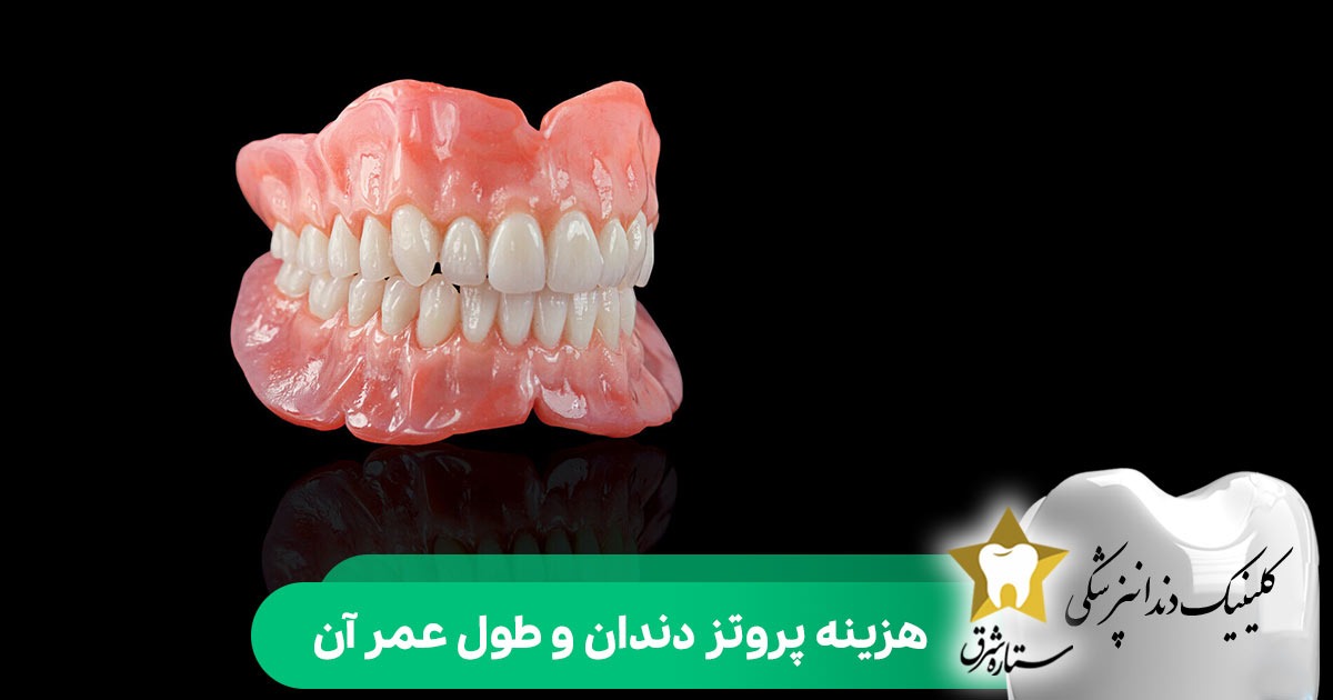 هزینه پروتز دندان و طول عمر آن