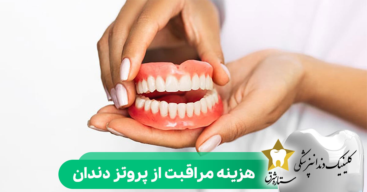 هزینه مراقبت از پروتز دندان