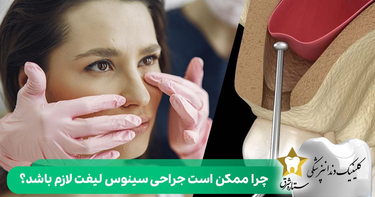 چرا ممکن است جراحی سینوس لیفت لازم باشد؟