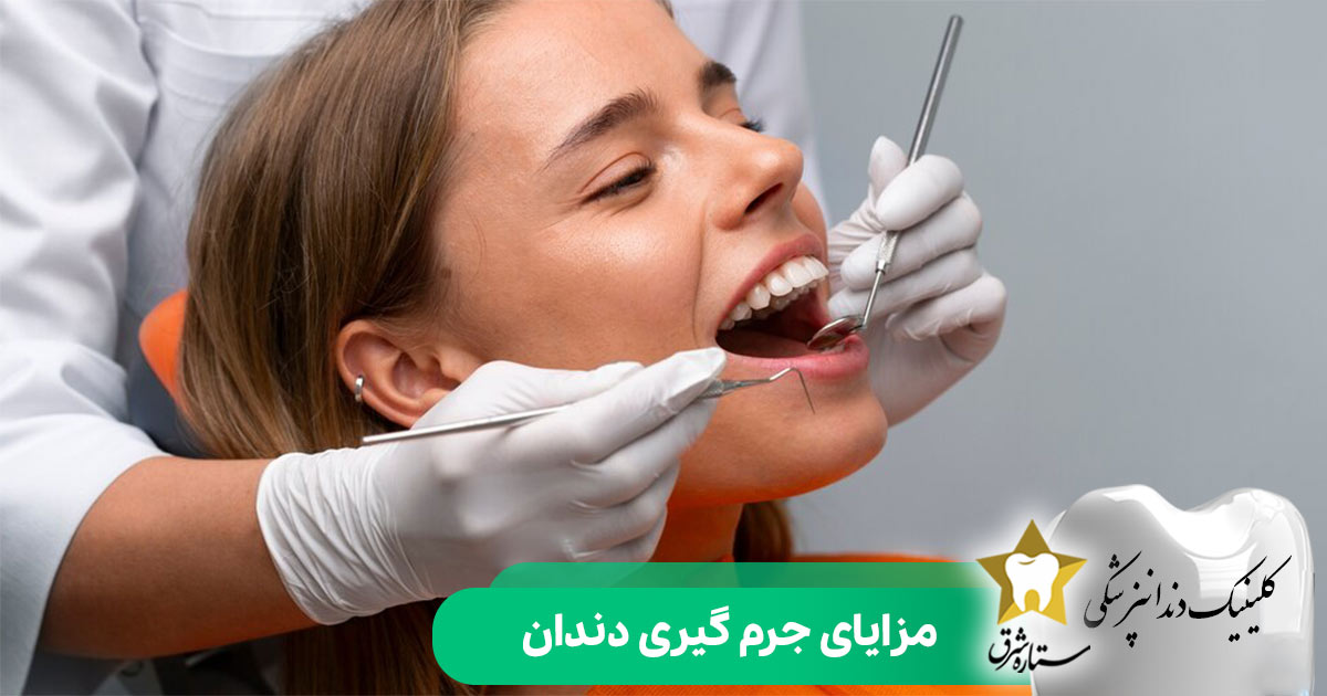 مزایای جرم‌گیری دندان