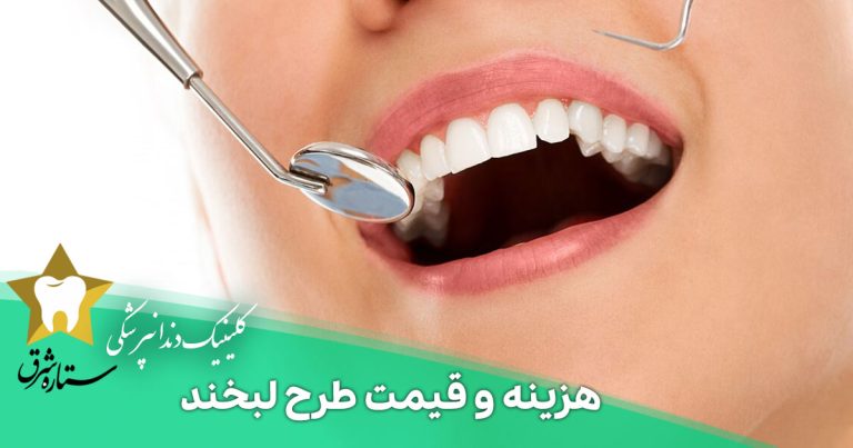 هزینه و قیمت طرح لبخند