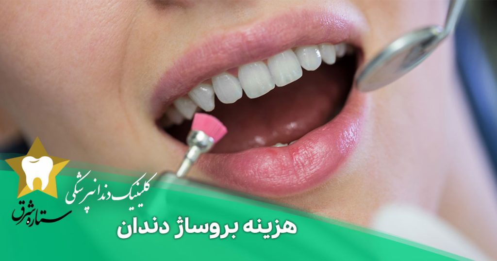 هزینه بروساژ دندان