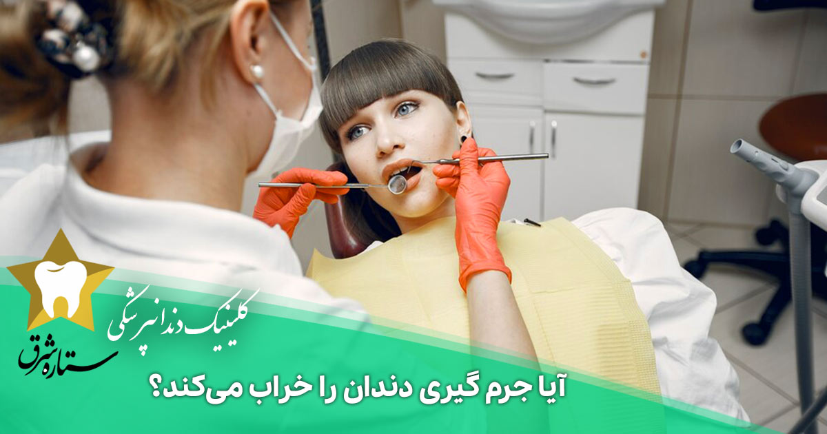 آیا جرم گیری دندان را خراب می‌کند؟