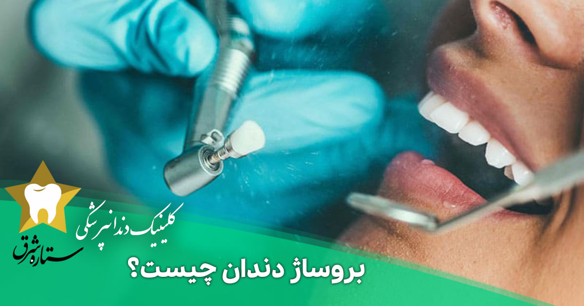 بروساژ دندان چیست؟