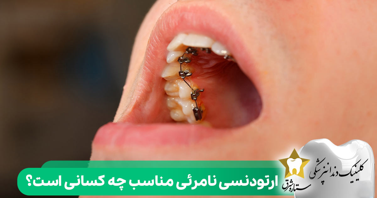 ارتودنسی نامرئی مناسب چه کسانی است؟