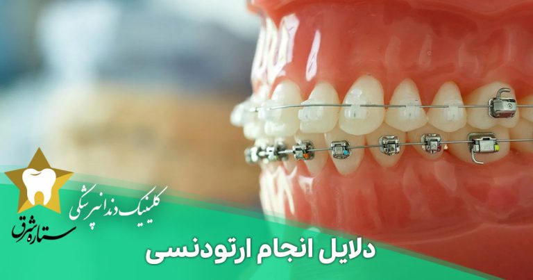 دلایل انجام ارتودنسی