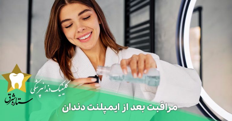 مراقبت‌ بعد از ایمپلنت دندان