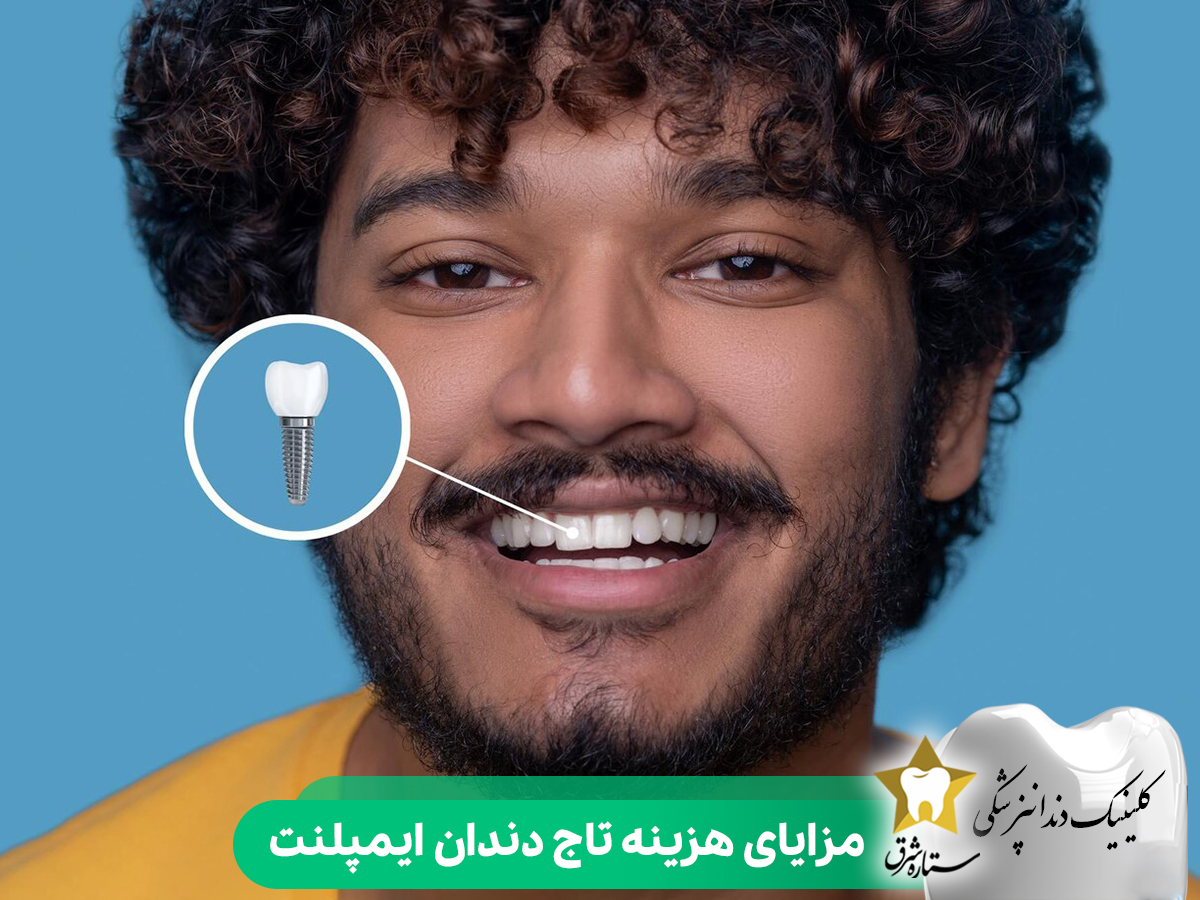 مزایای هزینه تاج دندان ایمپلنت