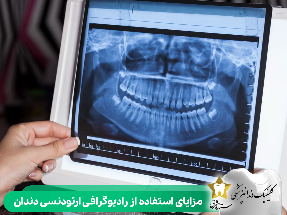 مزایای استفاده از رادیوگرافی ارتودنسی دندان